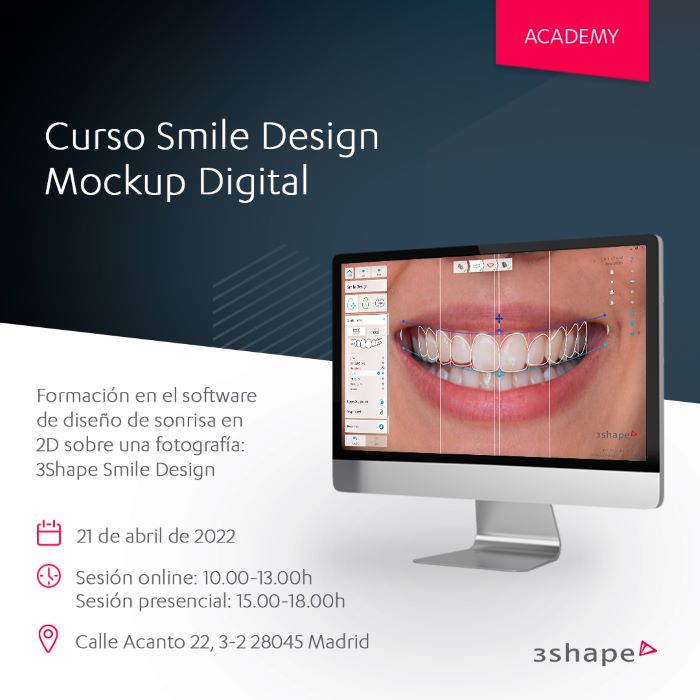3SHAPE – Smile design. Mock up Digital