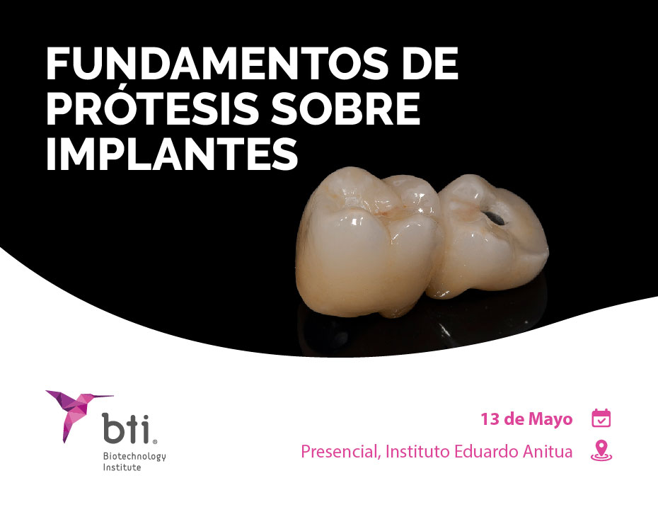 BTI. Fundamentos de prótesis sobre implantes