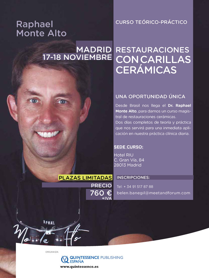 Restauraciones con carillas cerámicas