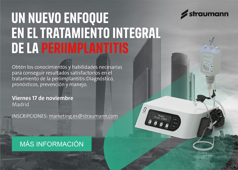 Un nuevo enfoque en el tratamiento integral de la periimplantitis