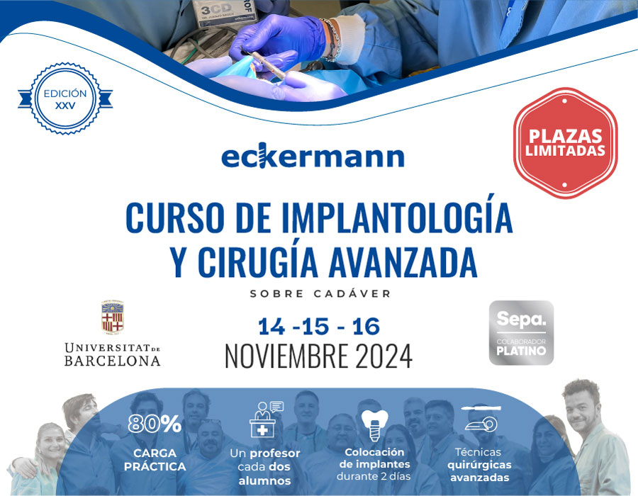 Curso de implantología y cirugía avanzada